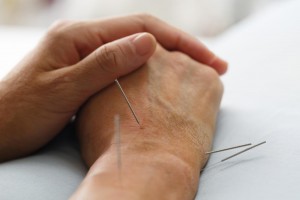 protibolečinska akupunktura